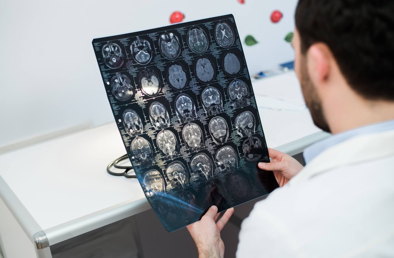 A medical professional examining a brain scan, possibly looking for signs of a brain tumor.